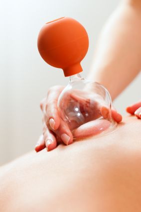 massage cupping