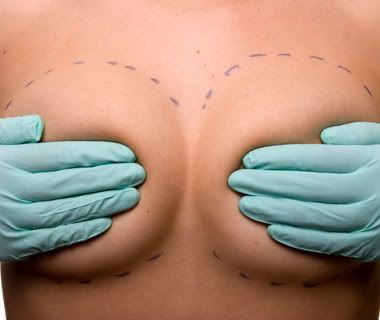 Breast Augmentation