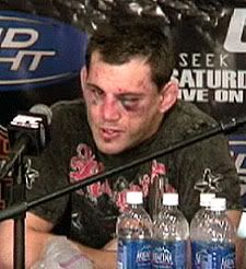 jon-fitch-cuts.jpg